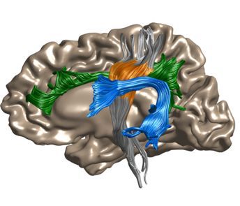 Analysis of diffusion MRI data